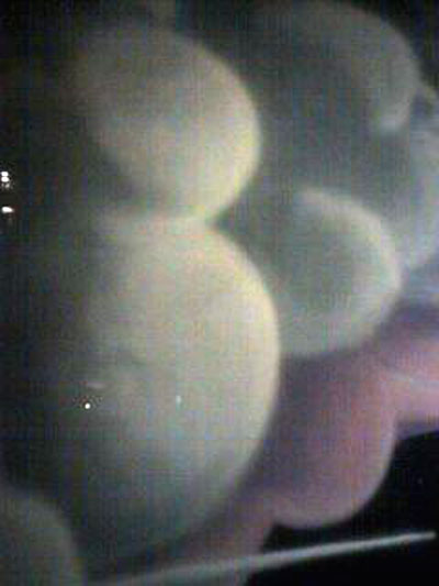 fBe[jAn[o[